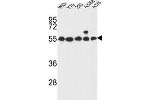 Western blot analysis in WiDr,Y79,293,A2058,A375 cell line lysates (35ug/lane) using GPR180/ITR Antibody . (GPR180 抗体  (Middle Region))