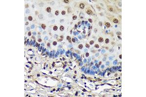 Immunohistochemistry of paraffin-embedded Human esophageal using FCF1 Rabbit pAb (ABIN7267162) at dilution of 1:100 (40x lens). (FCF1 抗体)