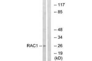 anti-RAC1+CDC42 (AA 38-87) antibody