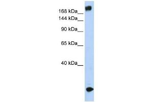 SCN5A antibody used at 1 ug/ml to detect target protein. (SCN5A 抗体  (N-Term))
