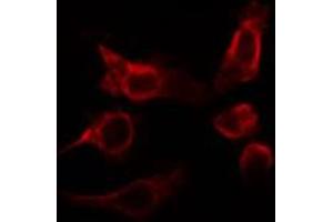 ABIN6266795 staining HepG2 cells by IF/ICC. (RHOBTB2 抗体)