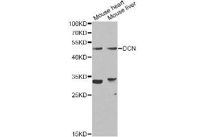 Western blot analysis of extracts of various cell lines, using DCN Antibody (ABIN5970829) at 1/1000 dilution. (Decorin 抗体)