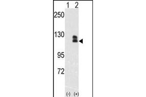 Western blot analysis of EphB2(arrow) using rabbit polyclonal EphB2 Antibody (ABIN391921 and ABIN2841731). (EPH Receptor B2 抗体)
