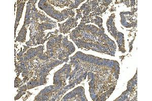 IHC analysis of EEF2 using anti-EEF2 antibody (ABIN7603141).