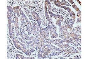 IHC analysis of GIT1 using anti-GIT1 antibody (ABIN7601683). (GIT1 抗体  (AA 415-736))