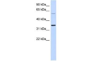 WB Suggested Anti-SASP Antibody Titration: 0. (ASPRV1 抗体  (Middle Region))