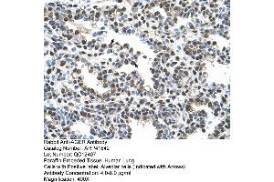 Rabbit Anti-AGER Antibody  Paraffin Embedded Tissue: Human Lung Cellular Data: Alveolar cells Antibody Concentration: 4. (RAGE 抗体  (C-Term))
