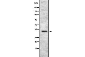 Western blot analysis OR4C12 using HuvEc whole cell lysates (OR4C12 抗体  (Internal Region))