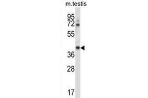 Western Blotting (WB) image for anti-Casein Kinase 1, gamma 1 (CSNK1G1) antibody (ABIN2997756) (CSNK1G1 抗体)