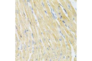 Immunohistochemistry of paraffin-embedded rat heart using GLRX Antibody (ABIN1876503) at dilution of 1:200 (40x lens). (Glutaredoxin 1 抗体)