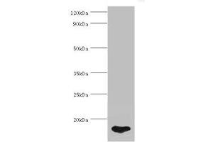 Western blot All lanes: FABP5 antibody at 5 μg/mL + HepG2 whole cell lysate Secondary Goat polyclonal to rabbit IgG at 1/10000 dilution Predicted band size: 15 kDa Observed band size: 15 kDa (FABP5 抗体  (AA 1-135))