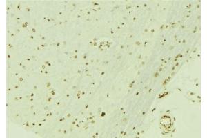 ABIN6276692 at 1/100 staining Mouse brain tissue by IHC-P. (Retinoblastoma Binding Protein 4 抗体  (C-Term))