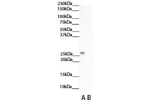 WB Suggested Anti-NNMT Antibody Titration:  0.