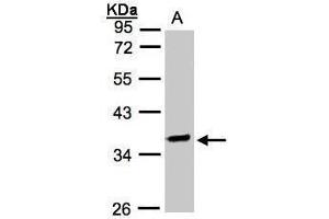 WB Image Sample(30 ug whole cell lysate) A:Raji , 10% SDS PAGE antibody diluted at 1:2000 (OSGEP 抗体)