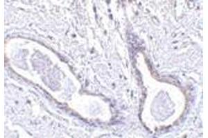 Immunohistochemistry of CCDC98 in human breast tissue with CCDC98 antibody at 5 μg/ml. (CCDC98 抗体  (N-Term))