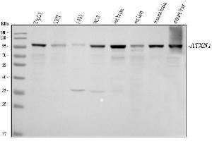 Western blot analysis of Ataxin 1 using anti-Ataxin 1 antibody (ABIN7602773).