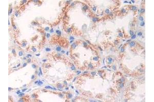 DAB staining on IHC-P;;Samples: Human Kidney Tissue (GLUD1 抗体  (AA 334-556))