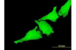Immunofluorescence of monoclonal antibody to TAOK3 on HeLa cell. (TAO Kinase 3 抗体  (AA 809-898))