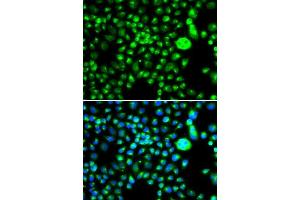 Immunofluorescence analysis of MCF-7 cells using SMCHD1 antibody. (SMCHD1 抗体  (AA 1756-2005))