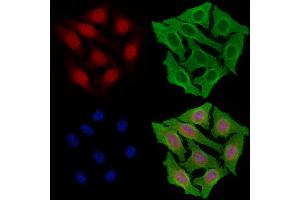 ABIN7094485 and ABIN7098534 staining Hela cells by IF/ICC. (KDM6A 抗体  (Internal Region))
