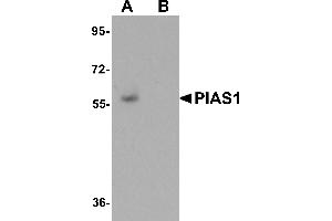 Western Blotting (WB) image for anti-Protein Inhibitor of Activated STAT, 1 (PIAS1) (C-Term) antibody (ABIN1030583)