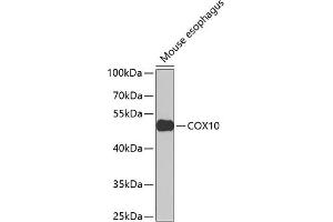 Western blot analysis of extracts of mouse esophagus, using COX10 Antibody (ABIN6133361, ABIN6138907, ABIN6138908 and ABIN6223449) at 1:1000 dilution. (COX10 抗体  (AA 1-160))