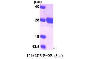 SURF1 Protein (AA 80-273) (His tag)