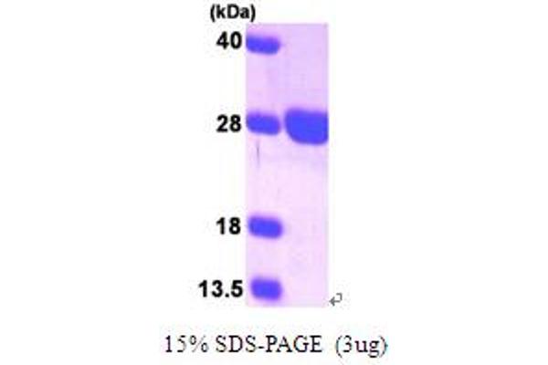 SURF1 Protein (AA 80-273) (His tag)