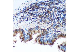 Immunohistochemistry of paraffin-embedded Rat lung using FBXO21 Rabbit pAb (ABIN7267085) at dilution of 1:100 (40x lens).