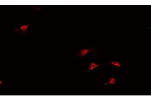 ABIN6266944 staining U-2 OS cells by IF/ICC. (HAND1 抗体  (Internal Region))