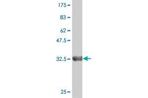 Western Blot detection against Immunogen (35. (Deoxyguanosine Kinase 抗体  (AA 1-89))