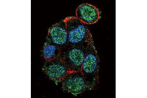 Immunofluorescence (IF) image for anti-Von Hippel-Lindau Tumor Suppressor, E3 Ubiquitin Protein Ligase (VHL) antibody (ABIN2905637) (VHL 抗体)