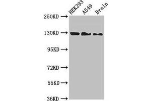 Western Blot Positive WB detected in: HEK293 whole cell lysate, A549 whole cell lysate, Mouse brain tissue All lanes: EIF4ENIF1 antibody at 2. (EIF4ENIF1 抗体  (AA 340-630))