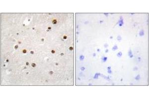 Immunohistochemistry analysis of paraffin-embedded human brain tissue, using TSN Antibody. (Translin 抗体  (AA 101-150))