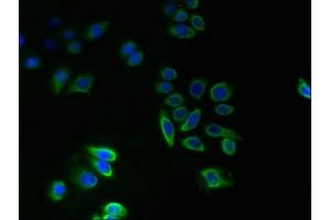 Immunofluorescent analysis of PC-3 cells using ABIN7173067 at dilution of 1:100 and Alexa Fluor 488-congugated AffiniPure Goat Anti-Rabbit IgG(H+L) (TMEM14A 抗体  (AA 45-78))