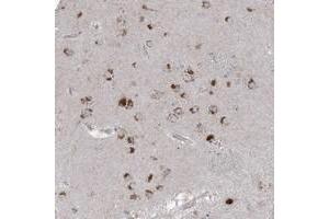 Immunohistochemical staining of human lateral ventricle with AGPS polyclonal antibody  shows strong cytoplasmic positivity in neuronal cells at 1:200-1:500 dilution.