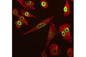 anti-Sp6 Transcription Factor (SP6) antibody