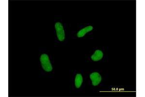 Immunofluorescence of purified MaxPab antibody to ZNF358 on HeLa cell. (ZNF358 抗体  (AA 1-481))
