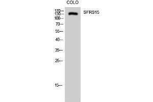 Western Blotting (WB) image for anti-SR-Related CTD-Associated Factor 4 (SCAF4) (Internal Region) antibody (ABIN3177385) (SCAF4 抗体  (Internal Region))