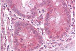 Anti-MAPK3 / ERK1 antibody IHC staining of human small intestine.