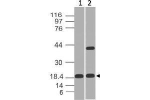 Image no. 1 for anti-Elastase 3B, Pancreatic (ELA3B) (AA 18-227) antibody (ABIN5027106) (Elastase 3B 抗体  (AA 18-227))