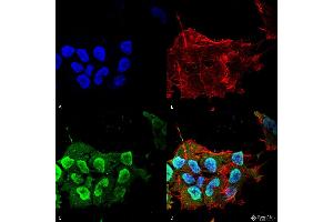 Immunocytochemistry/Immunofluorescence analysis using Mouse Anti-Ataxin 1 Monoclonal Antibody, Clone S65-37 . (Ataxin 1 抗体  (AA 746-761))