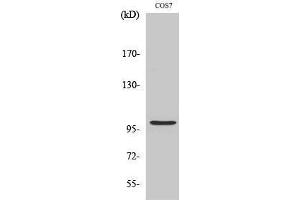 Western Blotting (WB) image for anti-AP2 associated kinase 1 (AAK1) (Internal Region) antibody (ABIN3183106) (AAK1 抗体  (Internal Region))