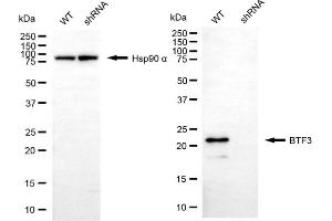 Western blotting analysis using BTF3 antibody (ABIN7797733).