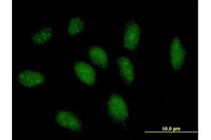 Immunofluorescence of purified MaxPab antibody to GCH1 on HeLa cell. (GCH1 抗体  (AA 1-250))