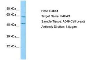 Image no. 1 for anti-Prolyl 4-Hydroxylase, alpha Polypeptide III (P4HA3) (AA 77-126) antibody (ABIN6750125) (P4HA3 抗体  (AA 77-126))