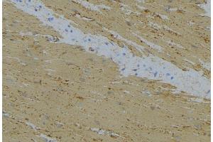 ABIN6274737 at 1/100 staining Mouse muscle tissue by IHC-P. (MRPL24 抗体  (Internal Region))