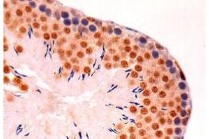 Immunohistochemistry (IHC) image for anti-Cyclin-Dependent Kinase 1 (CDK1) (AA 30-57), (AA 42-49) antibody (ABIN1449303)