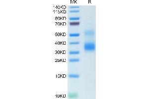 RANKL Protein (AA 63-244)