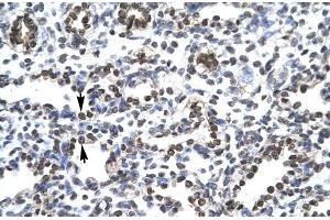 Immunohistochemistry (IHC) image for anti-Capicua Homolog (CIC) (N-Term) antibody (ABIN2779683)
